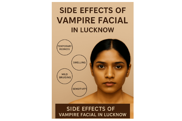 Lip Filler Treatment in Lucknow 